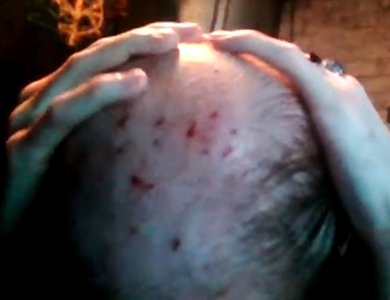 scab.png