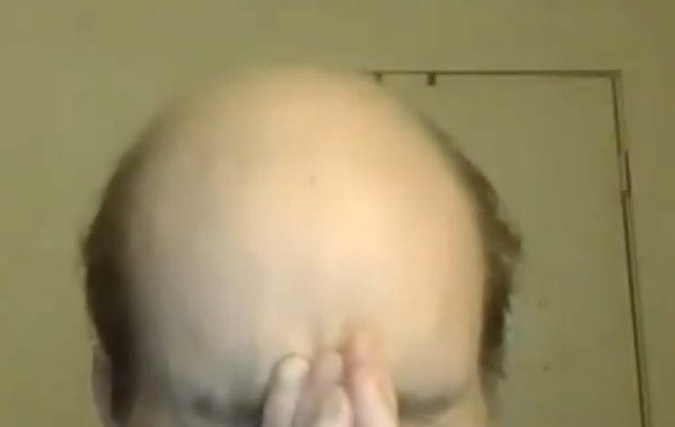 skullet2.png
